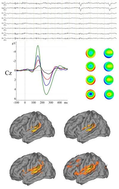 Fmri Eeg