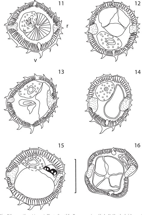 Figure From Description Of A New Species Of Heligmosomoides