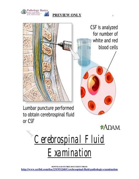 Csf Cerebrospinal Fluid Examination From Tapping To Pathological