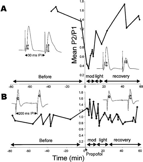 Time Course Of Action Of Propofol On Paired Pulse Population Spike