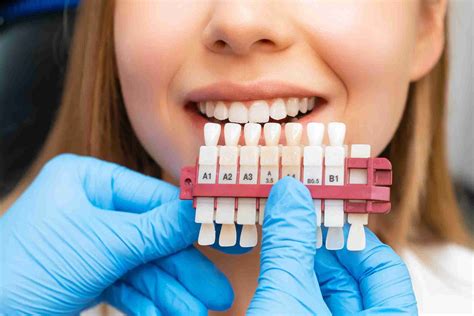 Carillas Dentales Valencia Amedent Clínica Dental en Valencia