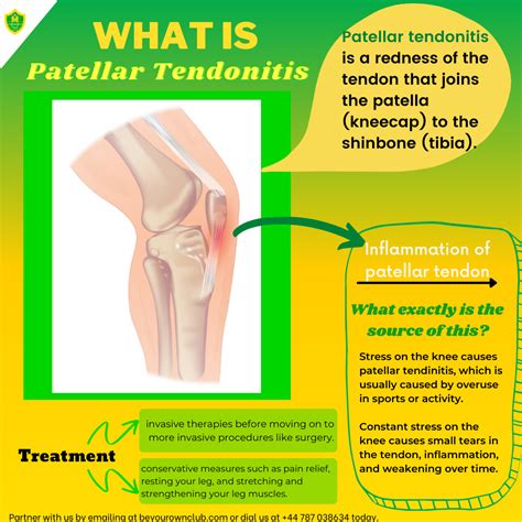 Patellar Tendonitis: Caused and Treatment - M. Hussein