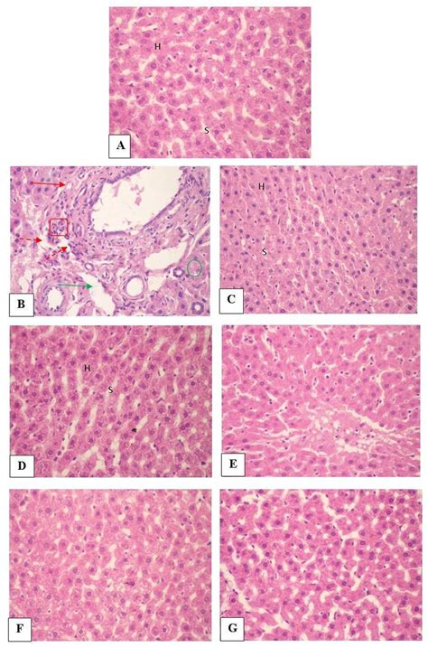 Light Photomicrograph Of Liver Sections A Control Group C Aç Download Scientific Diagram