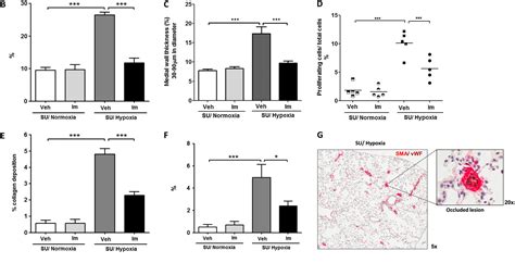 Figure From Imatinib Attenuates Hypoxia Induced Pulmonary Arterial