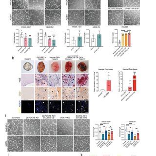 DEPDC1B Promotes Melanoma Growth Invasion Metastasis And