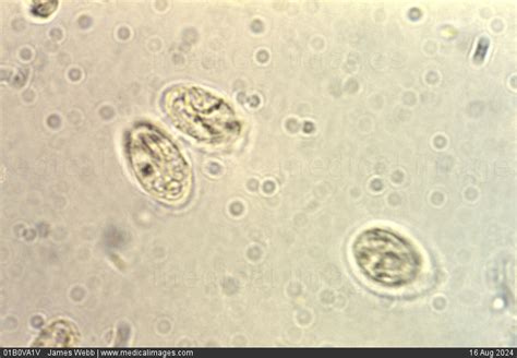 Giardia Lamblia Cyst Size