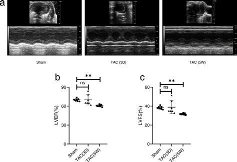 Chronic Pressure Overload Induced Left Ventricular Dysfunction A