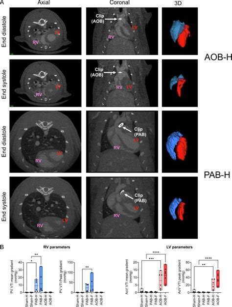 A Common Gene Signature Of The Right Ventricle In Failing Rat And Human