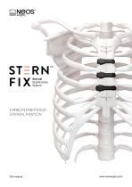 Ортопедическая проволока для закрытия груди - STERN FIX - NEOS Surgery ...
