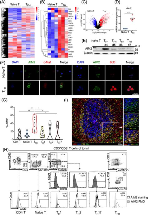 Absent In Melanoma 2 AIM2 Is Highly Expressed In Human T Follicular