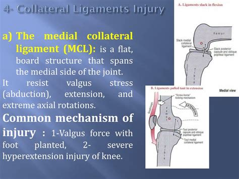 Ppt Pathomechanics Of Knee Joint Part Ii Powerpoint Presentation