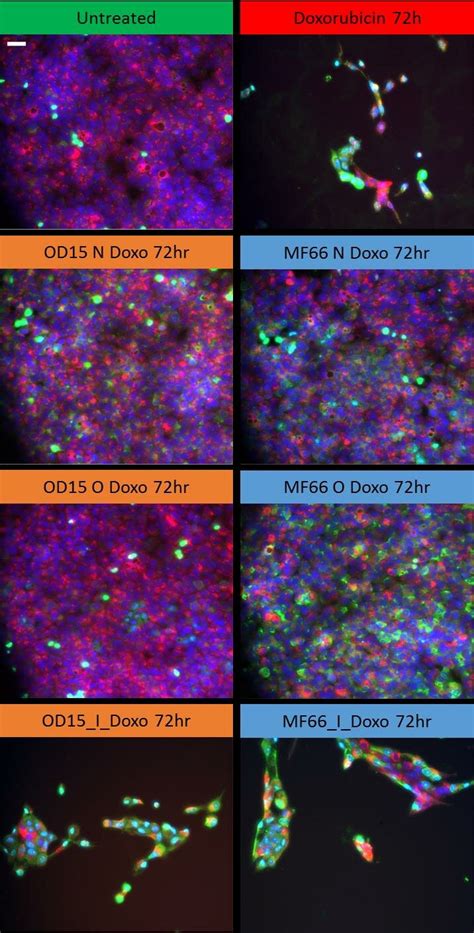 Mcf 10a Cell Line Exposed To Doxorubicin And Mnp Formulations Download Scientific Diagram