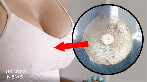 Why Women Are Removing Their Breast Implants Part 1 Youtube