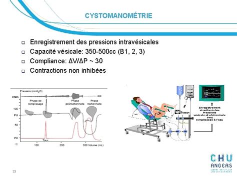 Diagnostic Et Traitement De Lincontinence Urinaire Pr Pierre