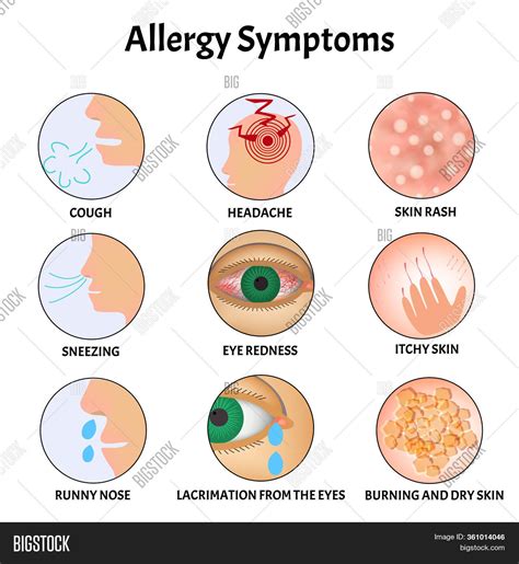 Symptoms Allergies Image & Photo (Free Trial) | Bigstock