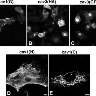 Immunoelectron Microscopic Localization Of Caveolin In Golgi Fractions