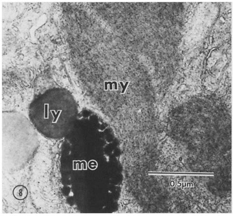 Electron micrograph of a lysosome found within the RPE . my, myeloid... | Download Scientific ...