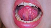 Teeth Videos Xvideos