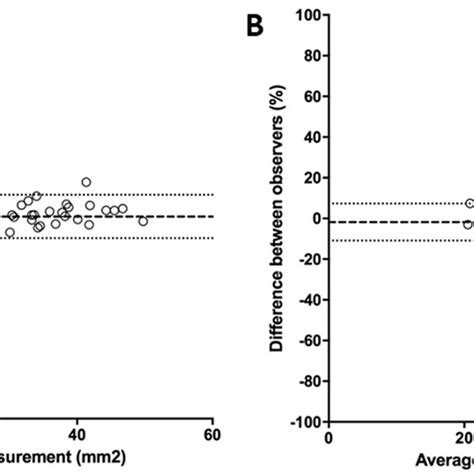 Fetal Heart Using Spatio Temporal Image Correlation In The Rendering