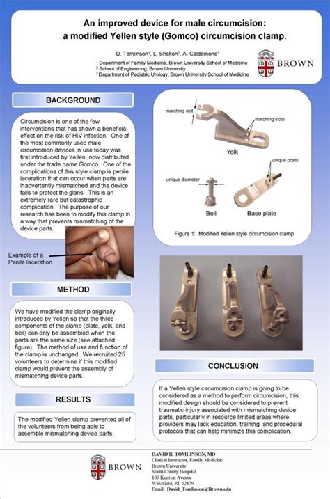 Upgrading Circumcision Tools To Prevent HIV TheBodyPRO