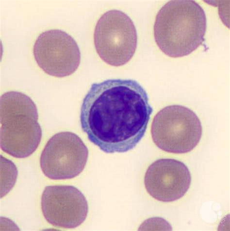 Lymphocytes