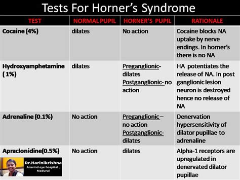 Test for Horner's Syndrome - EyeToday