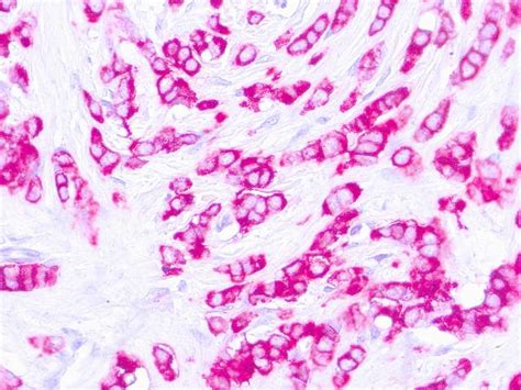 Epithelial Membrane Antigen Ema E Mob Histoline