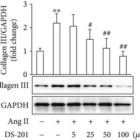 DS 201 Prevents Ang II Induced Fibrotic Response In Atrial Fibroblasts