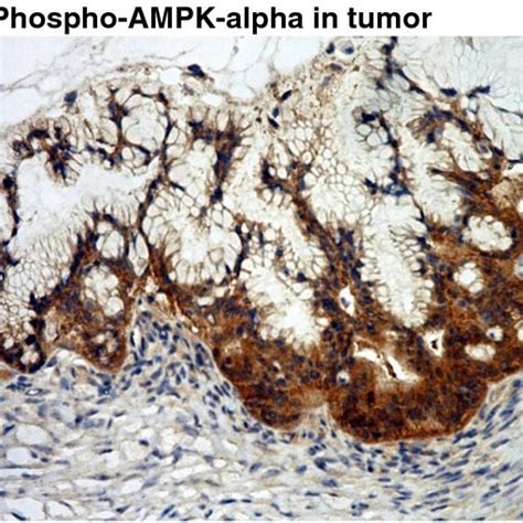 Immunohistochemical staining of pAMPK α expression in ovarian tissue