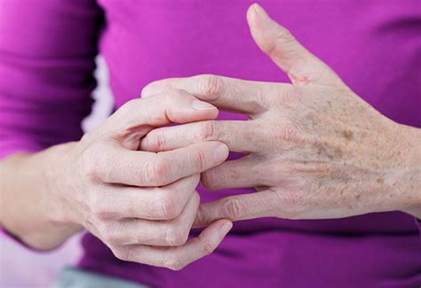 Rheumatoid Arthritis Symptoms Artofit