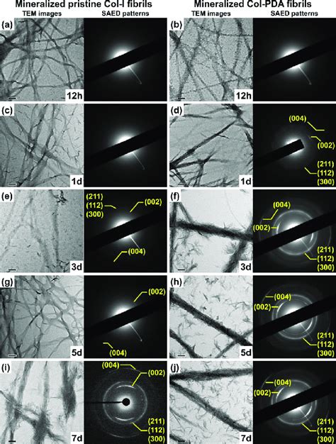 Bright Field TEM Images And Corresponding SAED Patterns Of The