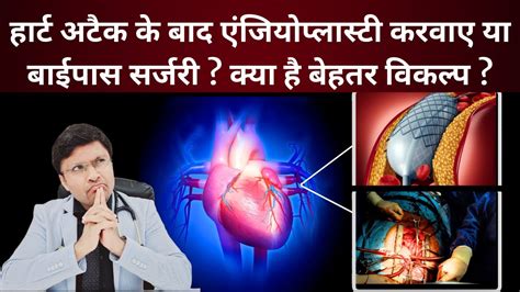 Angioplasty Vs Bypass Surgery Comparative Analysiswhich Is Better For You Youtube