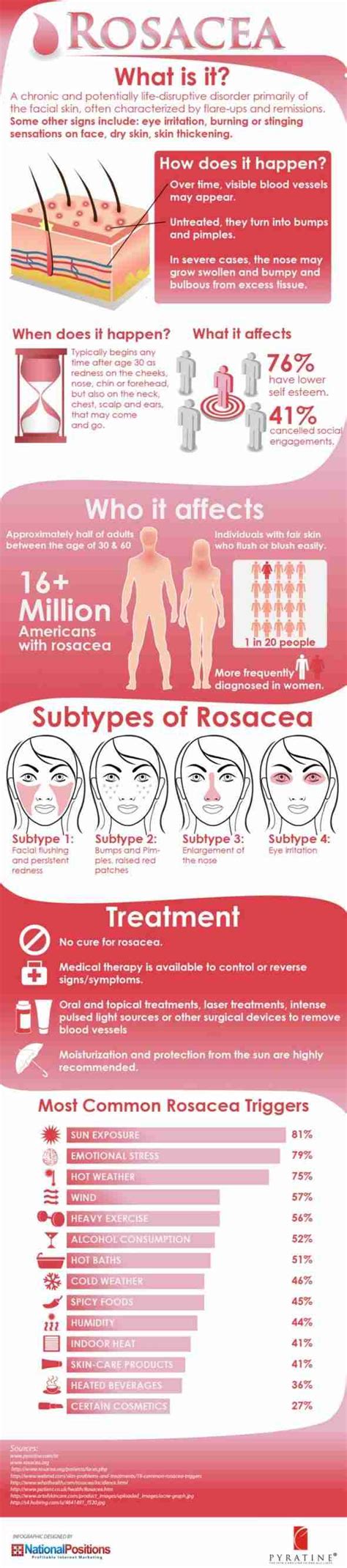 What Causes Rosacea? | Infographics Archive