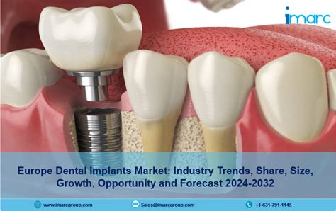 Europe Dental Implants Market Size Trends Overview Report 2024 2032