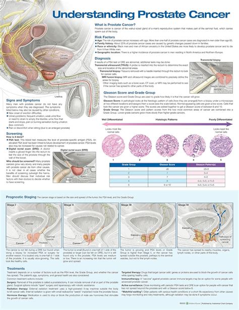 Understanding Prostate Cancer Anatomical Chart Anatomical Chart