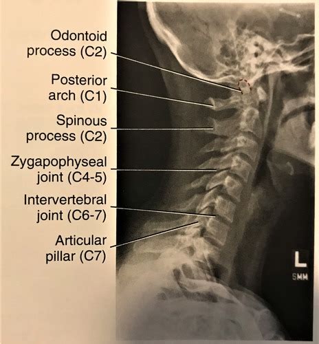 DMI 132 Cervical Spine Radiographic Positioning Flashcards Quizlet