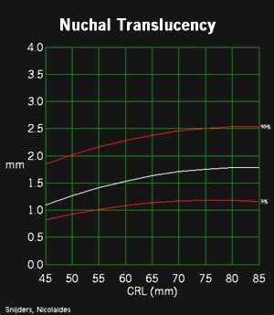 Nuchal Translucency Chart Measurements