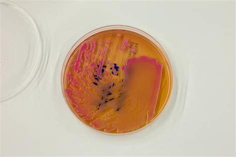 Premium Photo | Bacteria in culture media in the laboratory