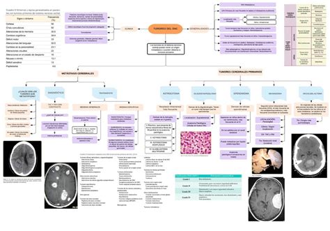 Sistema Nervioso Central Tumores Del Sistema Nervioso Central The