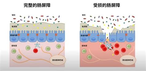 肠漏症是什么，怎么判断自己是否有肠漏症？肠道健康 肠道健康知识 肠道健康吃什么 肠道健康的重要性