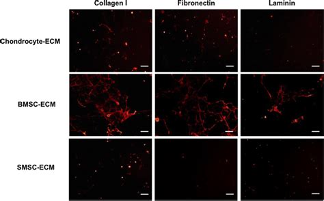 Expression Of Relevant Ecm Proteins In Cell Derived Ecm Produced From