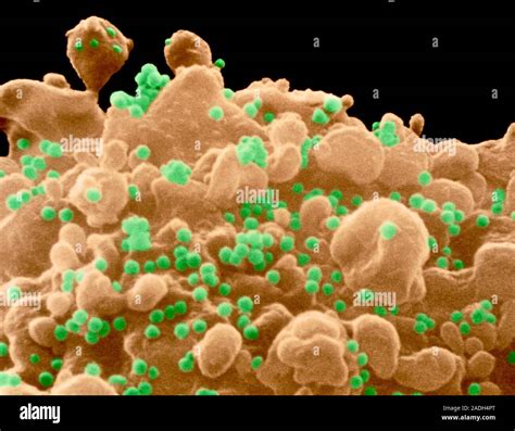 AIDS Virus Coloured Scanning Electron Micrograph SEM Of The Surface