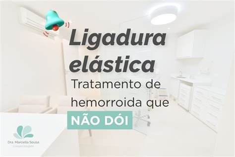 Ligadura El Stica Para Hemorroidas Tratamento Sem Cirurgia