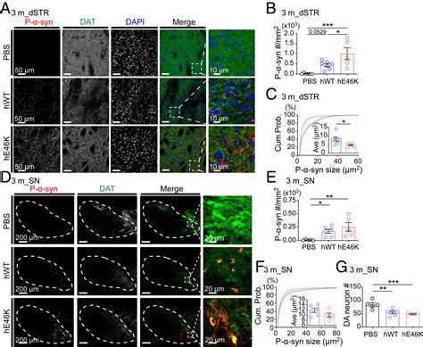 Wild Type α Synuclein Inherits The Structure And Exacerbated