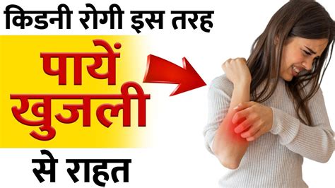 How To Stop Itching Skin किडनी रोगी खुजली कैसे दूर करें Youtube