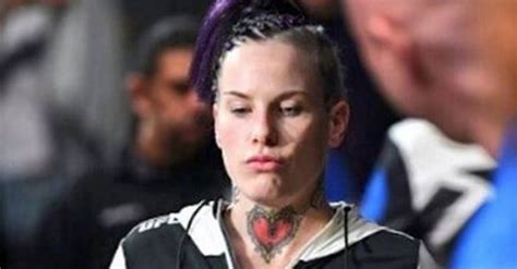 Ufcs Rowdy Bec Rawlings Raising Money For Much Needed Surgery Mma