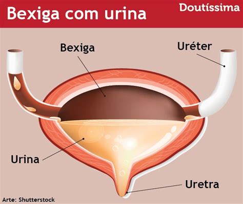 Sangue na urina veja como tratar a hematúria