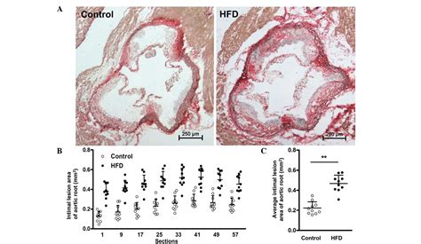 Practical Assessment Of The Quantification Of Atherosclerotic Lesions