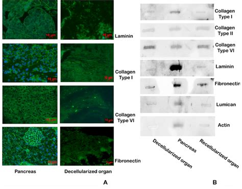 Characterization Of Decellularized Scaffold A Immunochemistry Of The