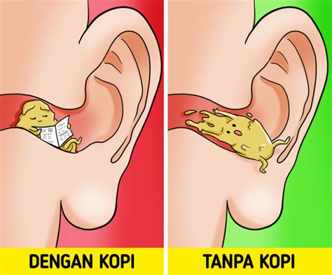 Cara Menjaga Telinga Bersih Lebih Lama Sisi Terang